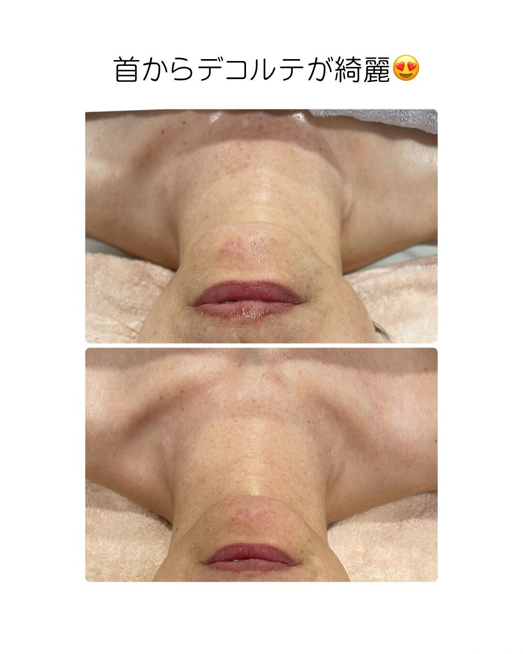 multi_image