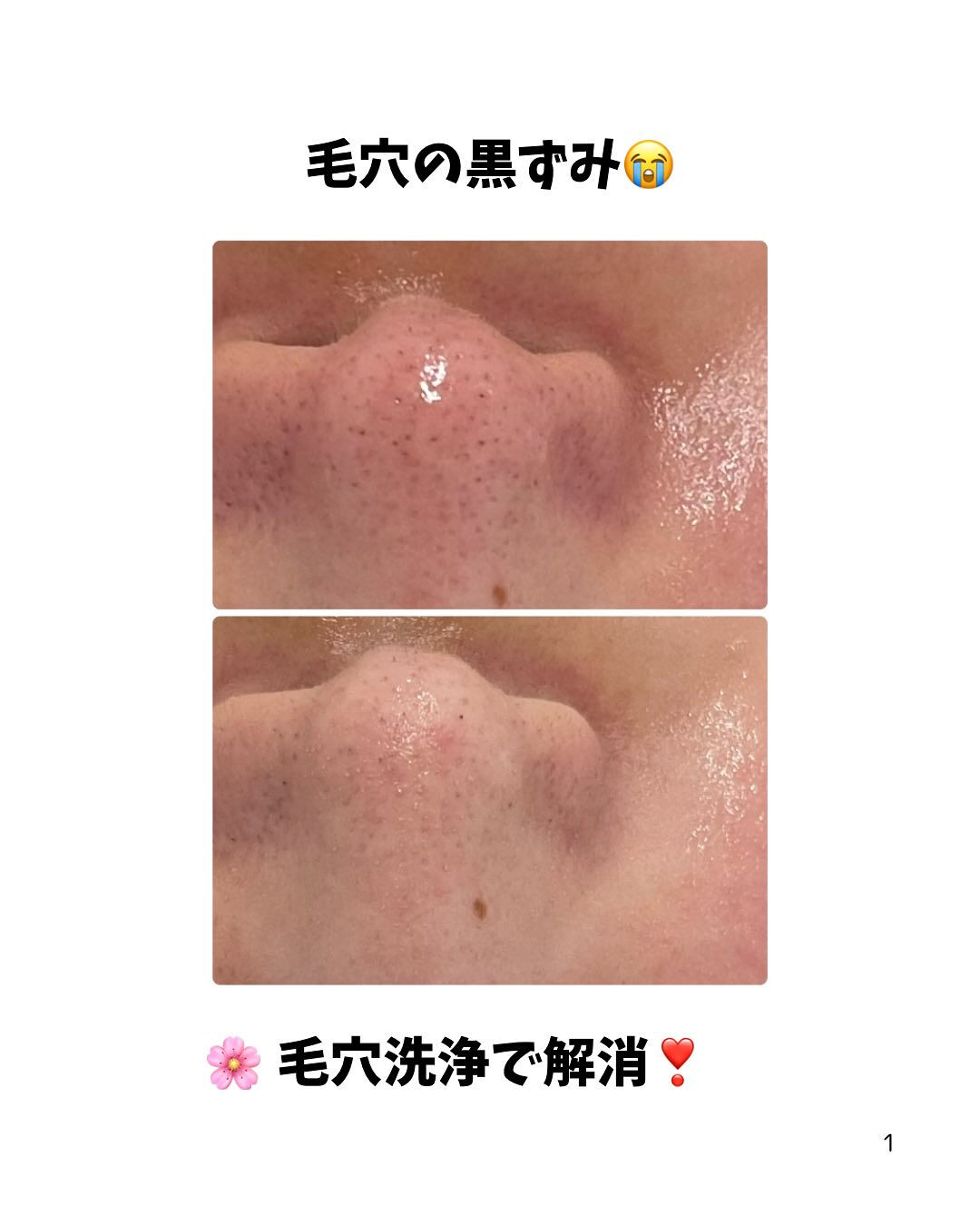 長野県塩尻市のCRATIS 塩尻店では毛穴の黒ずみやお肌のザ