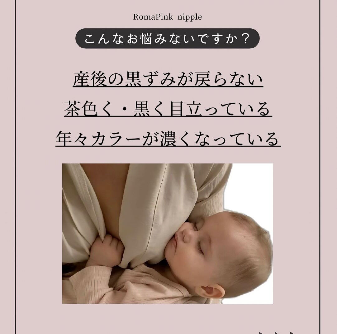長野県塩尻市のCRATIS  Shiojiriでは、色素沈着