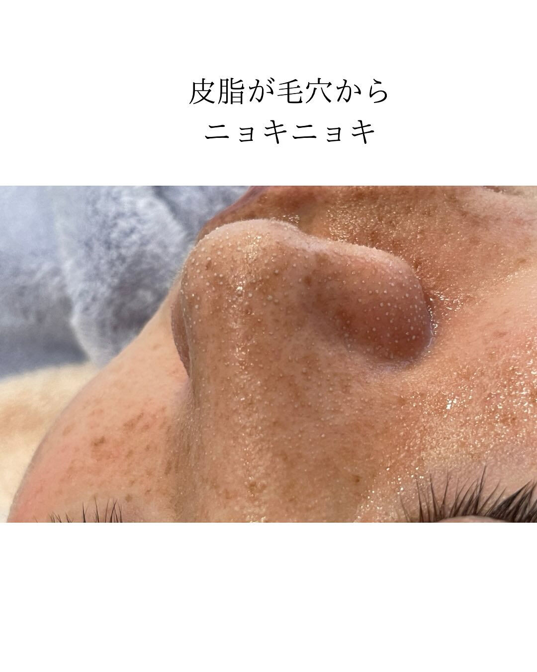 【長野県塩尻市 エステサロン CRATIS Shiojiri