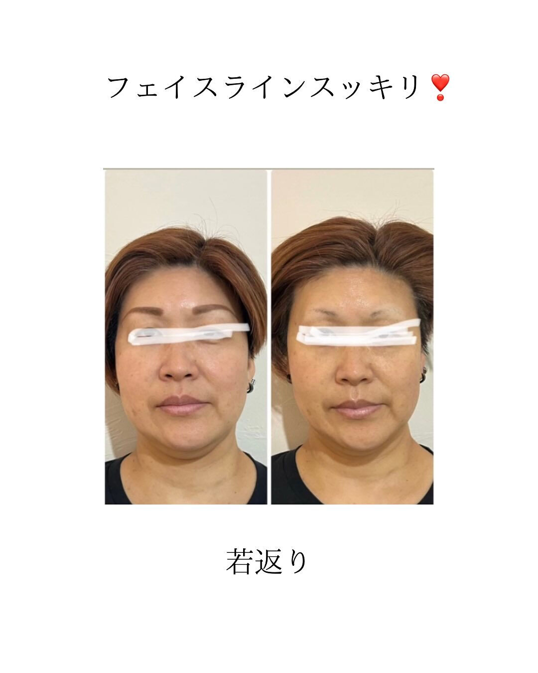 🌟【塩尻市のエステサロン】CRATIS Shiojiri🌟