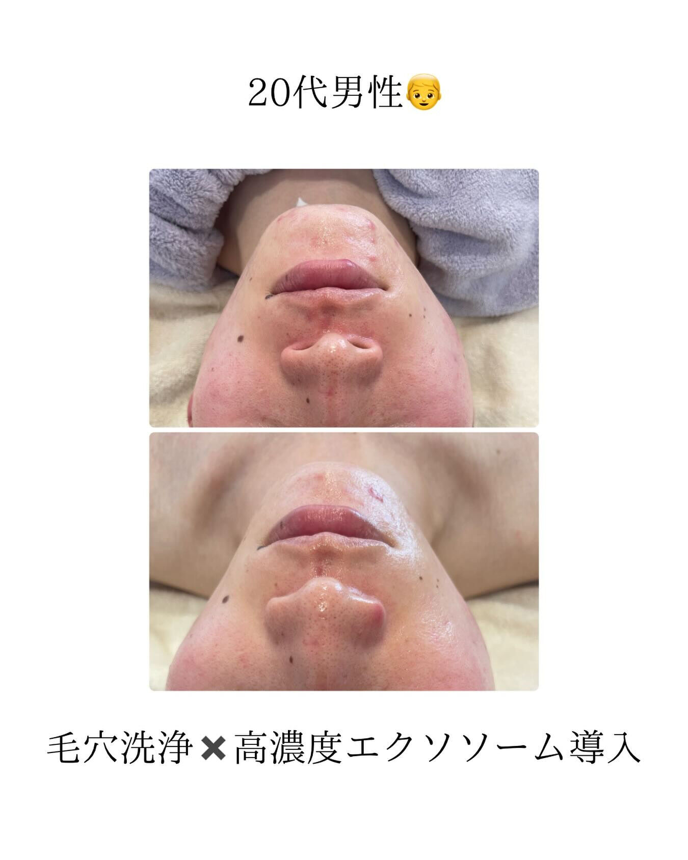長野県塩尻市エステサロン