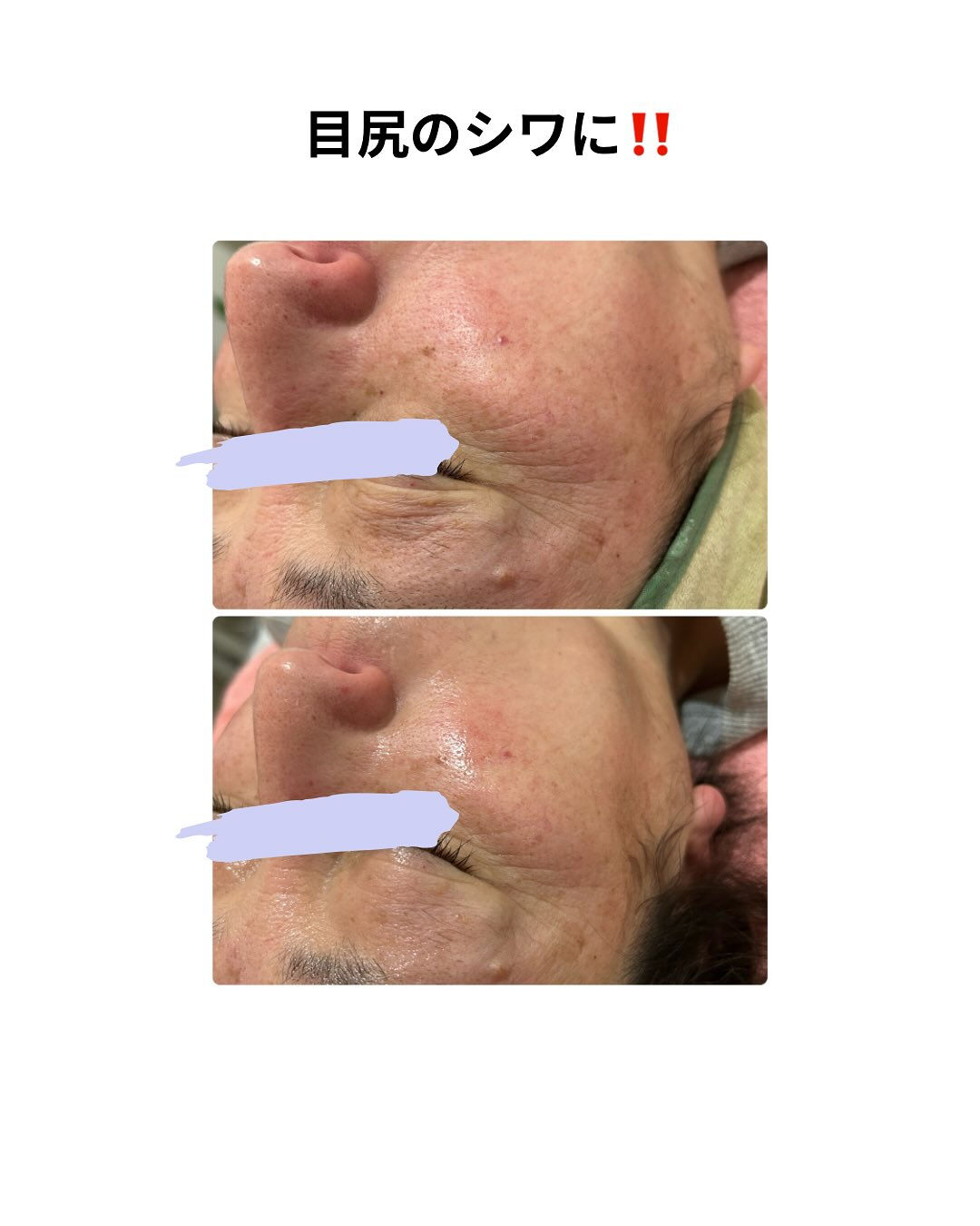 長野県塩尻市エステサロン