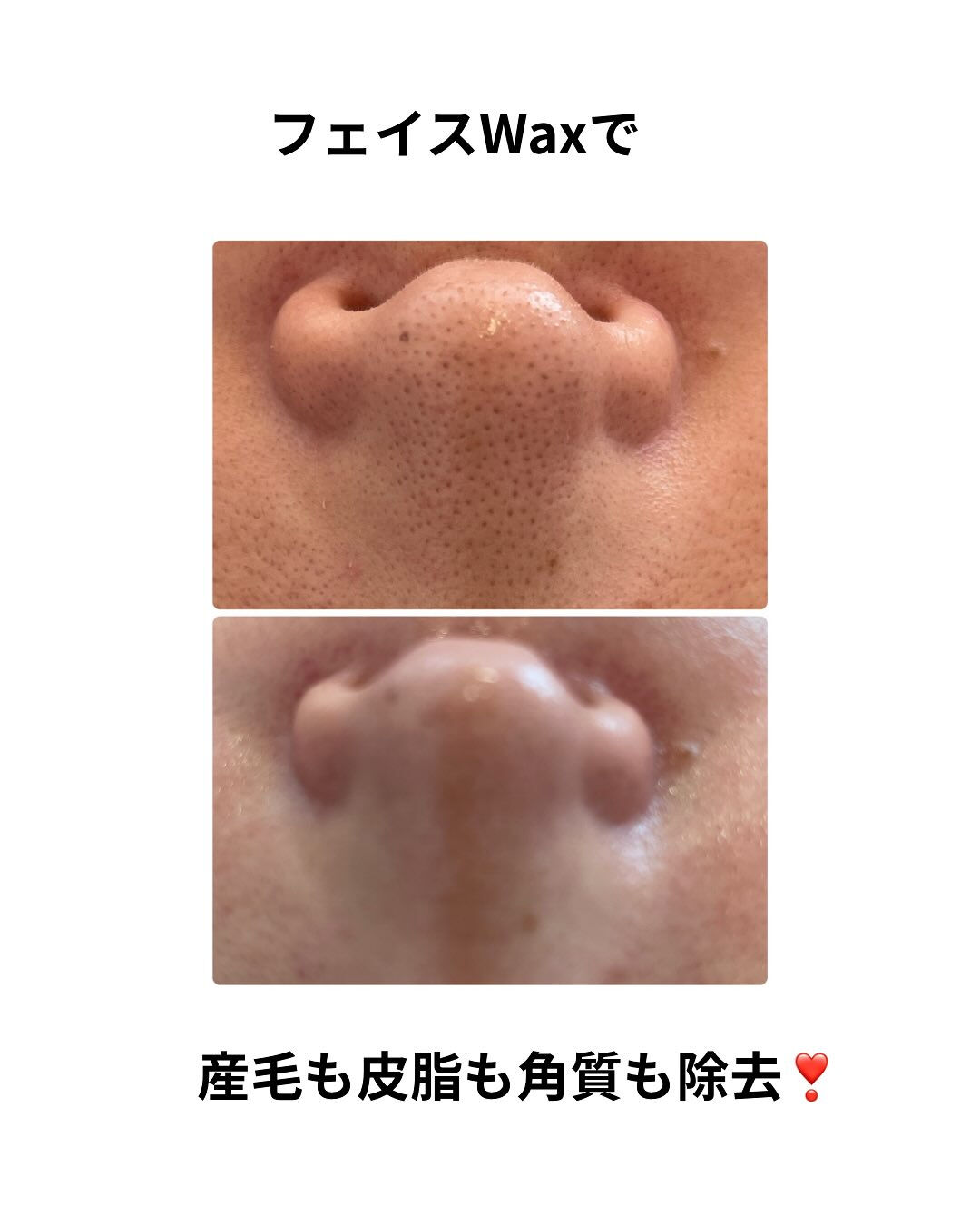 長野県塩尻市エステサロン