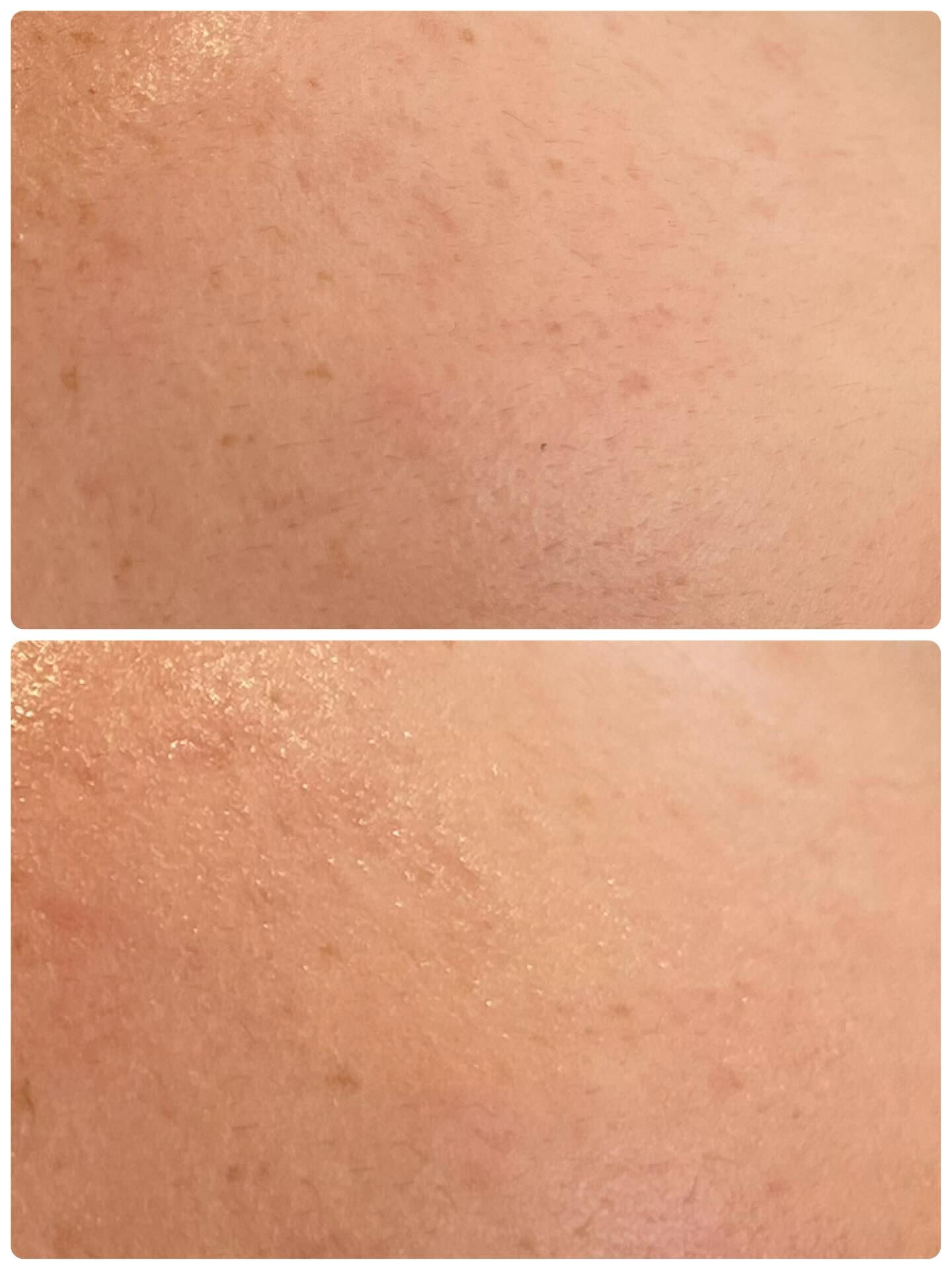 お顔の産毛はフェイスWaxが効果的です❣️