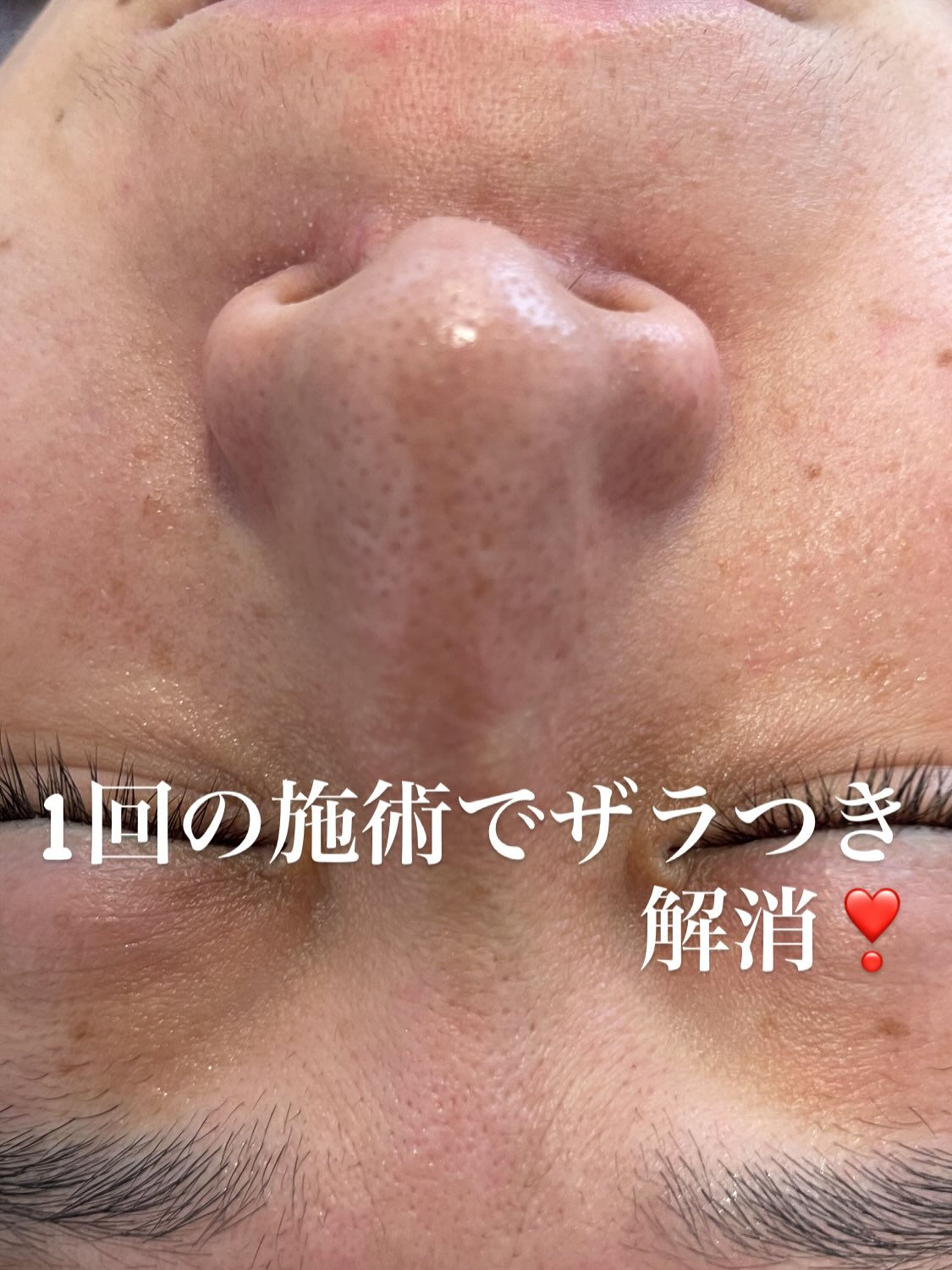 長野県塩尻市エステサロン