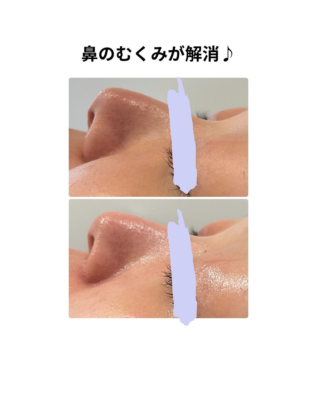 🌿長野県塩尻市エステサロン