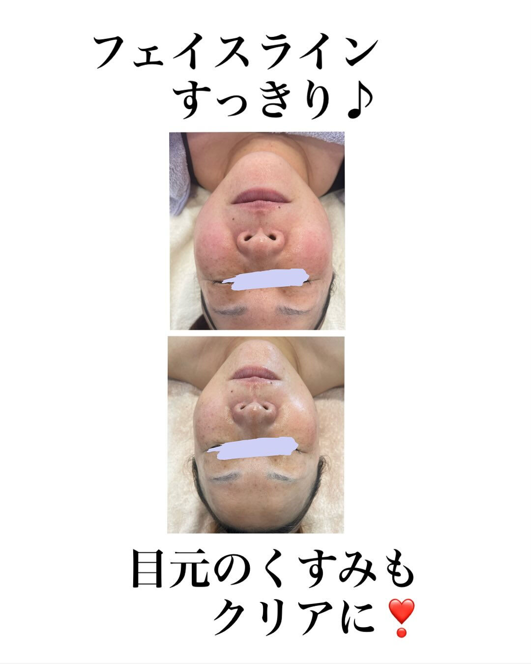 長野県塩尻市エステサロン
