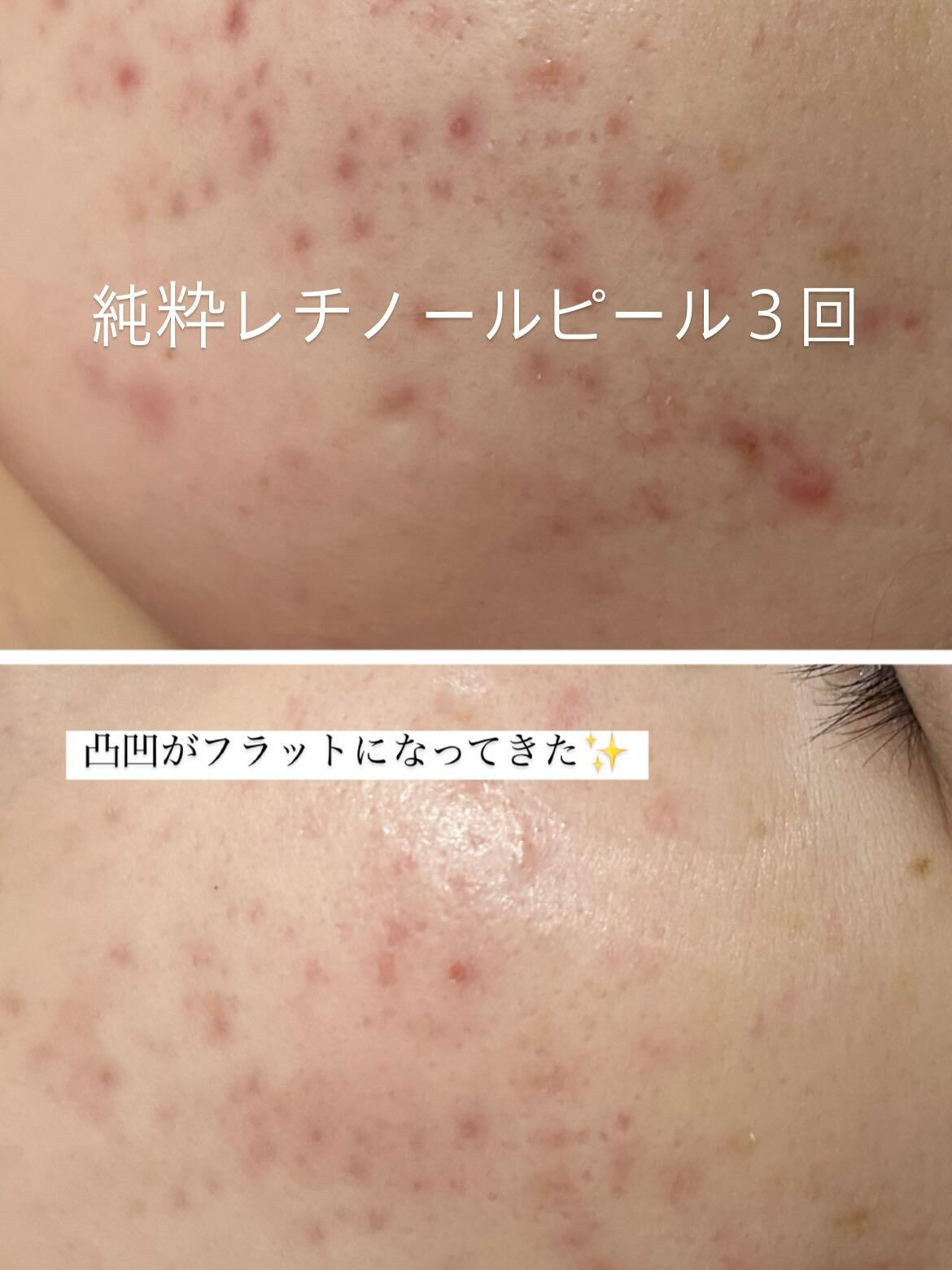 長野県塩尻市エステサロン