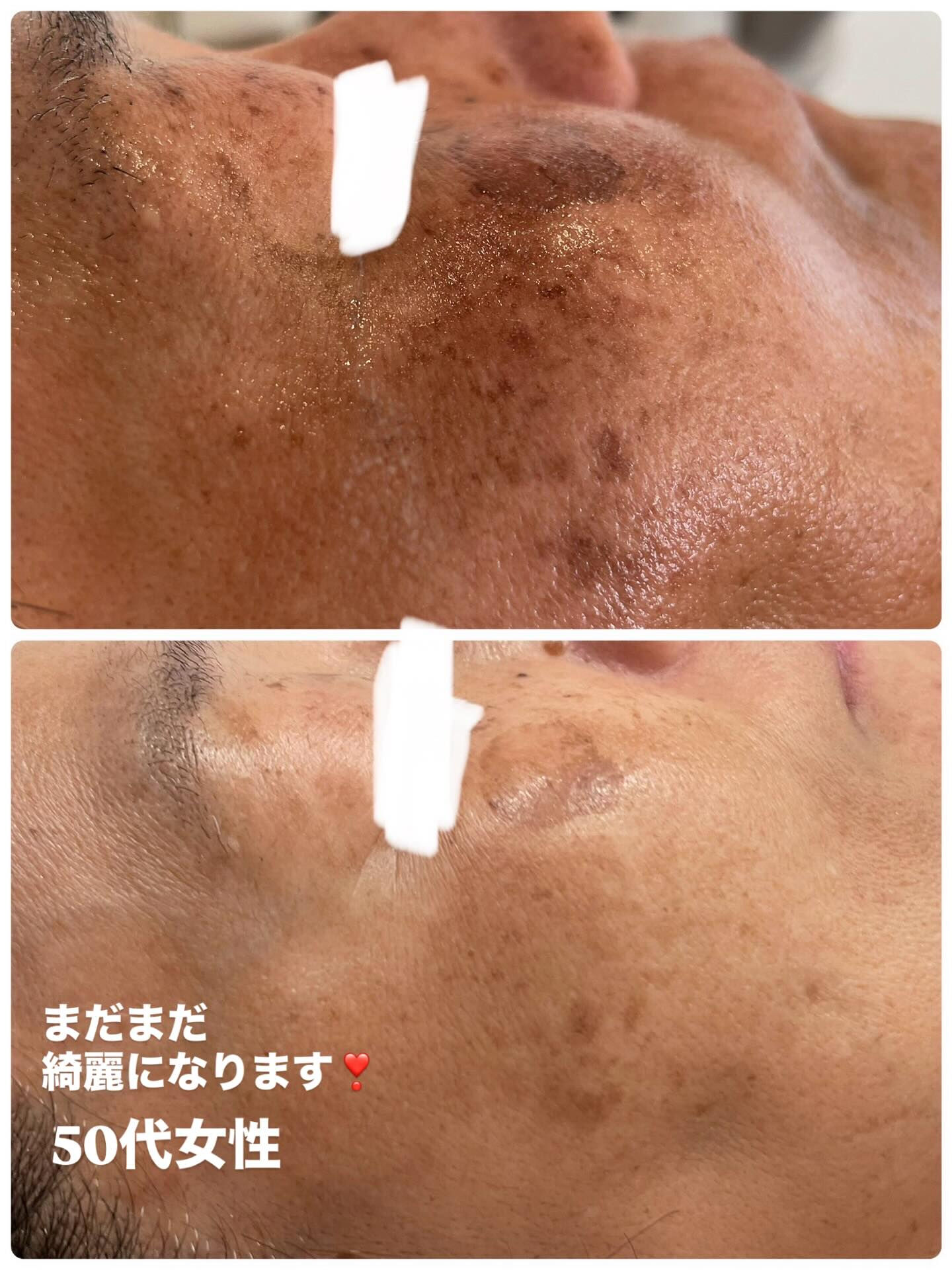 長野県塩尻市エステサロン