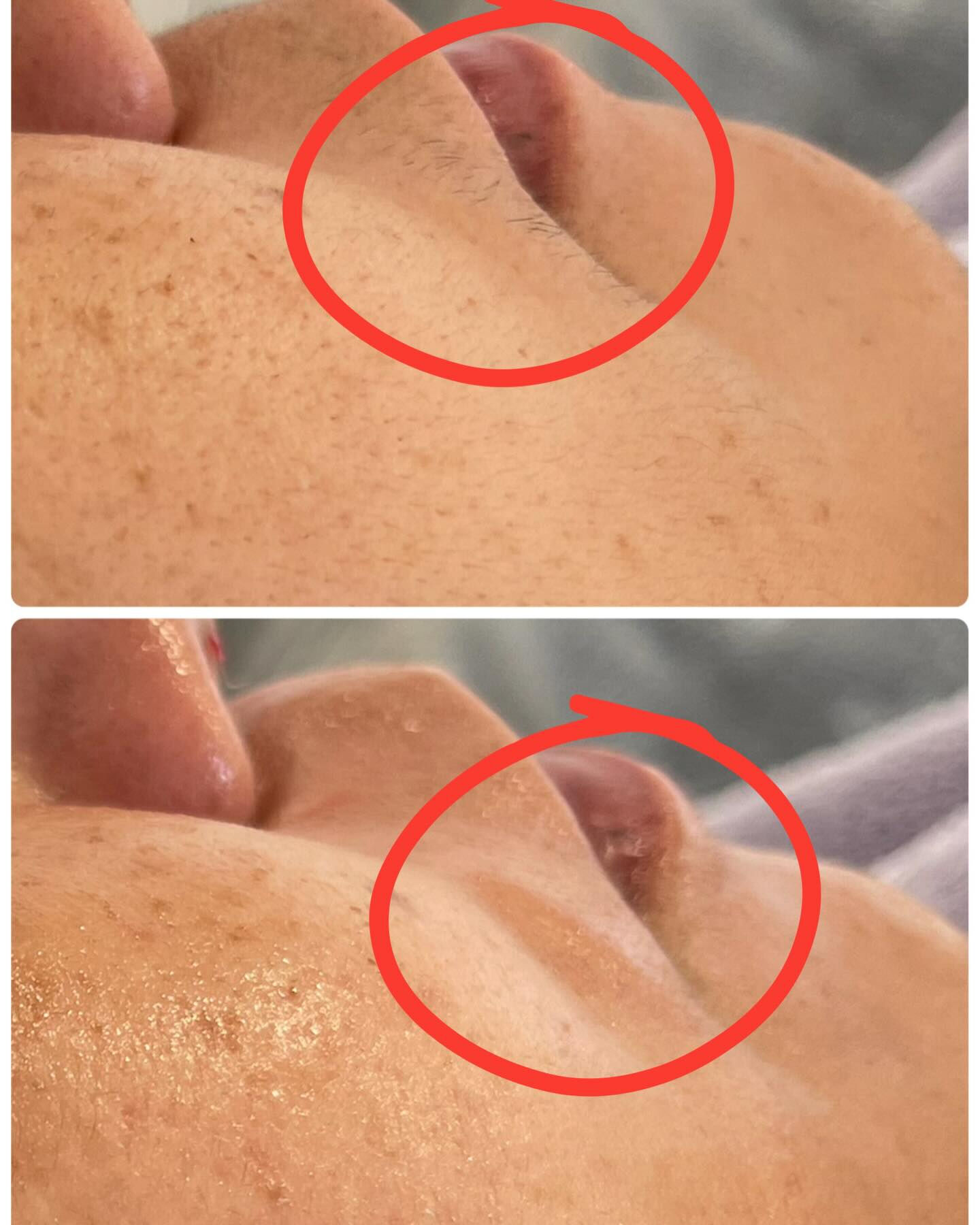 やみつきフェイスWaxで産毛と古い角質をすっきりオフ