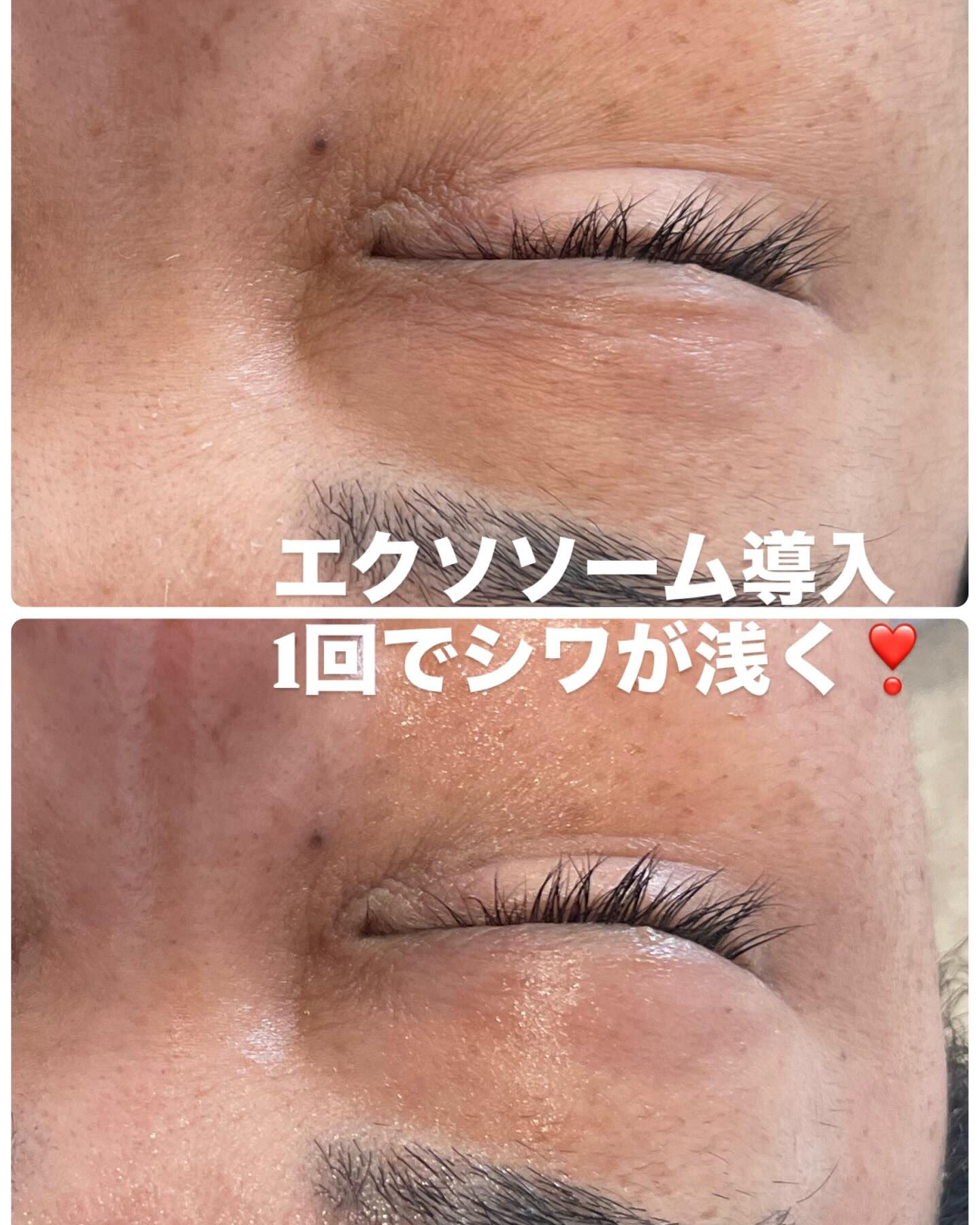 やみつきフェイスWaxで産毛と古い角質をすっきりオフ